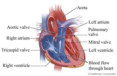 HVI Normal Heart